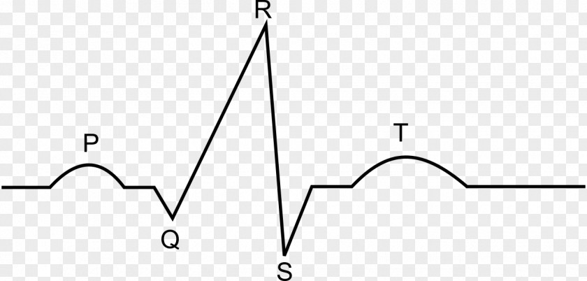 Heart Electrocardiogram Electrocardiography Medicine Drawing PNG