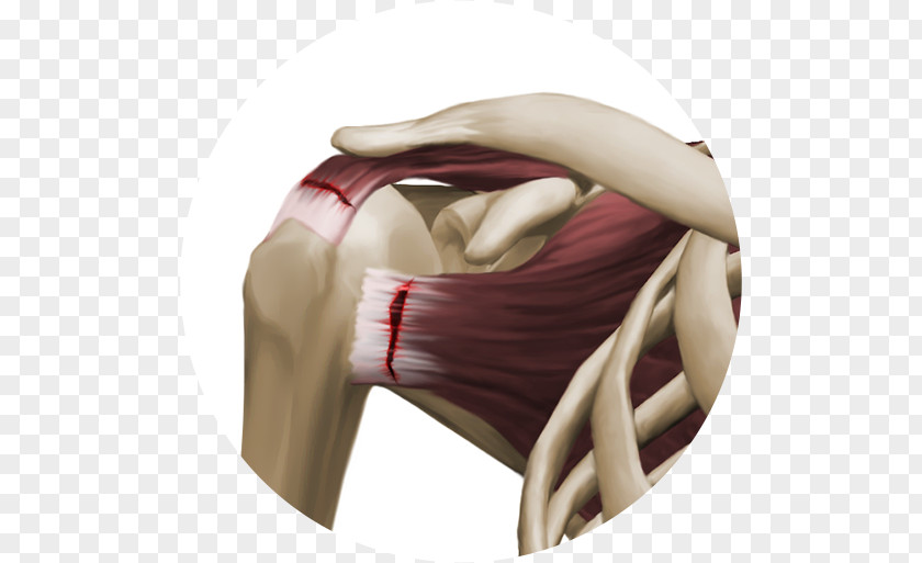 Design Shoulder Knee PNG