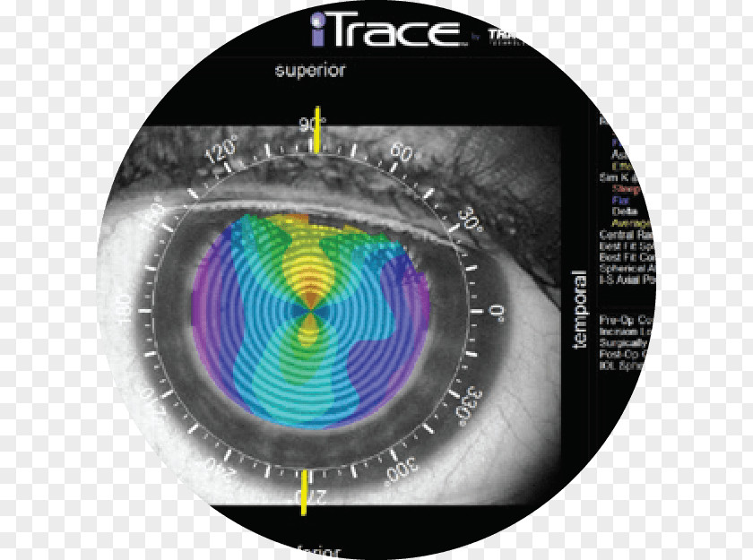 Eye Ophthalmology Examination Astigmatism Far-sightedness PNG