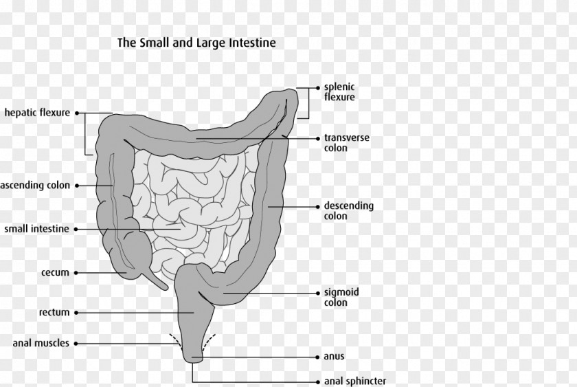 Small Intestine Colectomy Bowel Resection Large Surgery Sigmoid Colon PNG