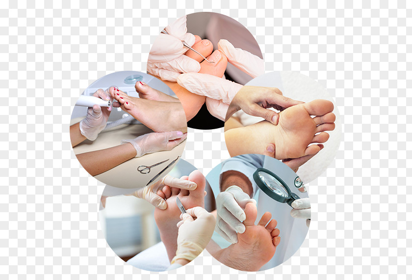 Health Plasencia Podiatry Podiatrist Foot Therapy PNG