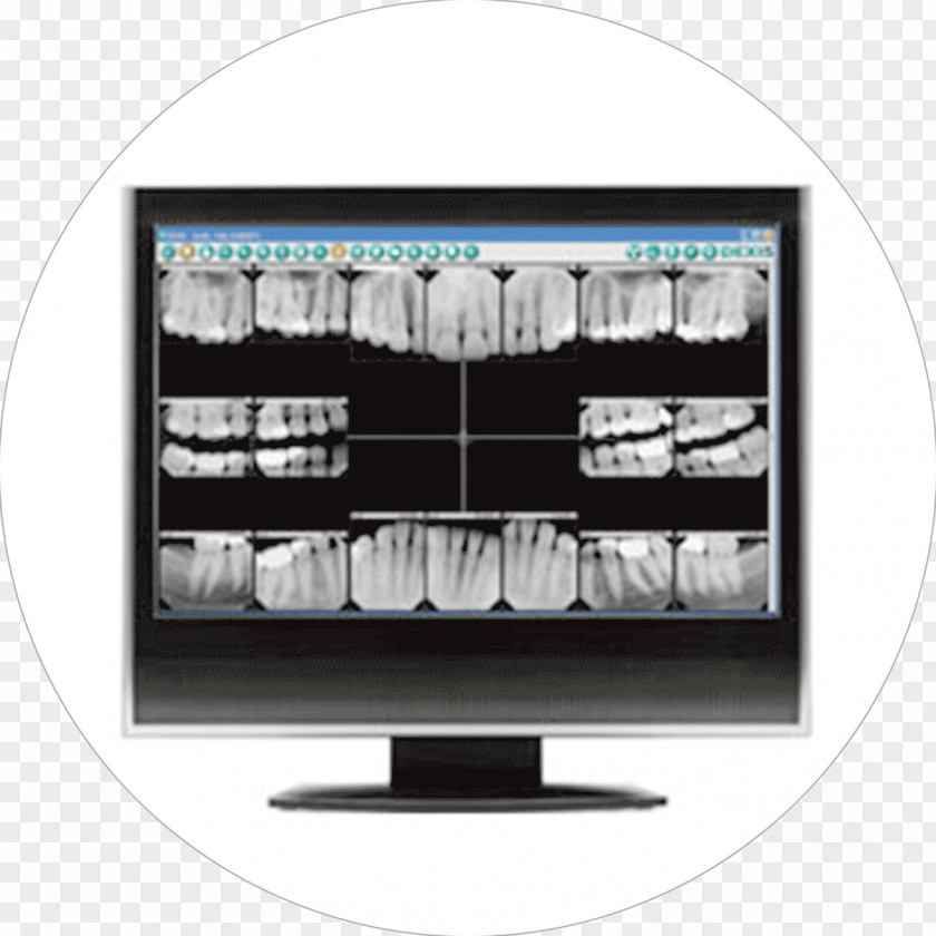 Dentistry Digital Radiography Tooth PNG