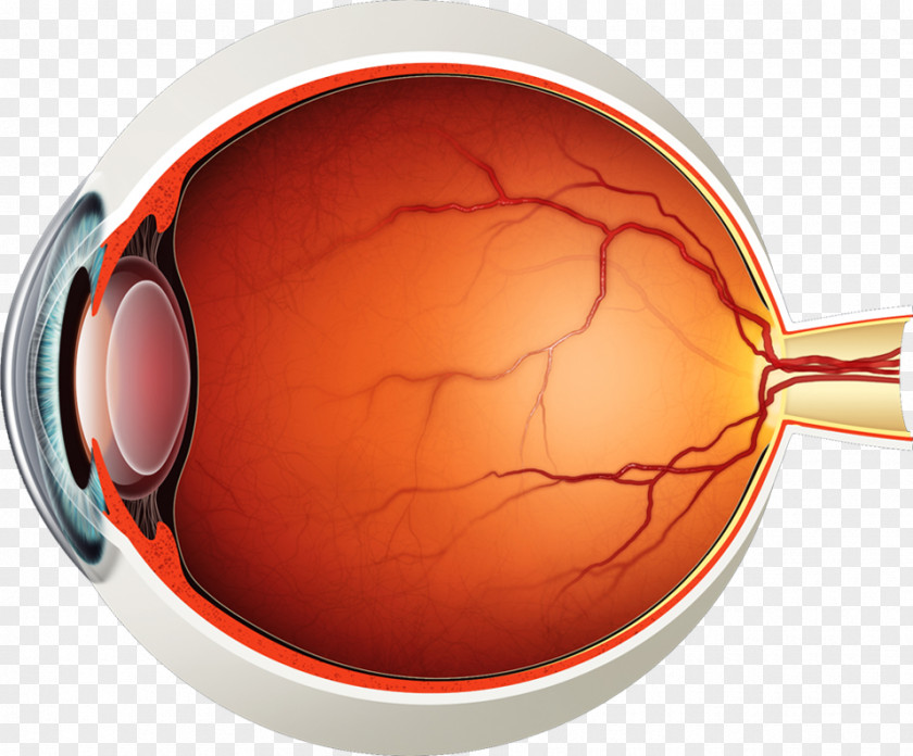 Anatomy Vitreous Body Posterior Detachment Floater Retinal PNG