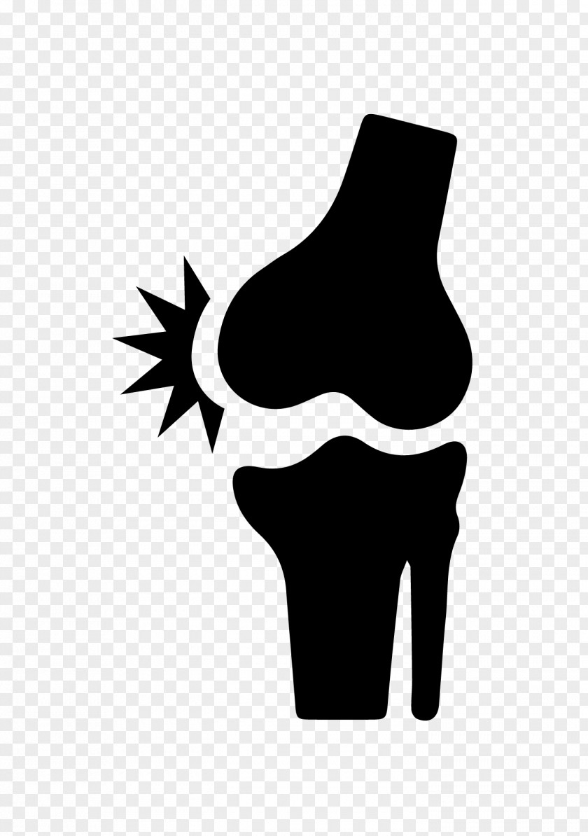 Bone Knee Pain Back Joint PNG