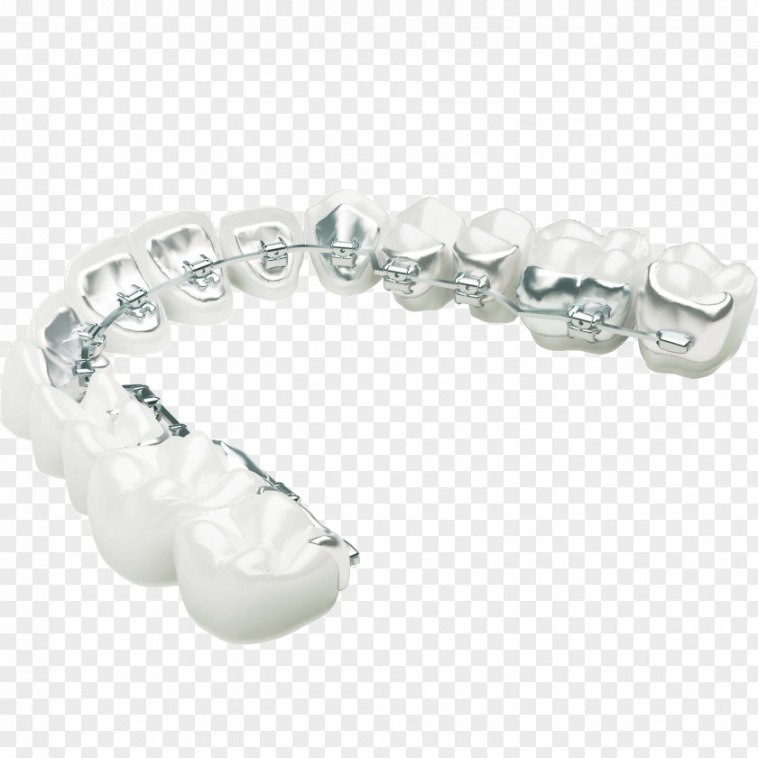 Braces Lingual Orthodontics Dental Clear Aligners Orthodontic Technology PNG