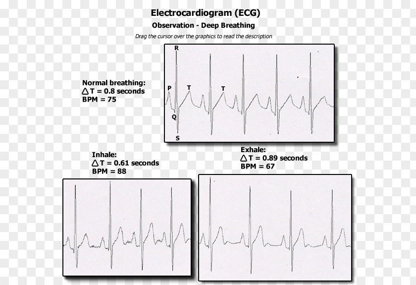 Line Paper /m/02csf Drawing Diagram PNG