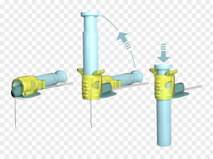 Catheter Jacket Cardiomed Supplies Inc Hypodermic Needle Needlestick Injury Patient PNG