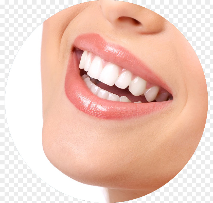Bridge Tooth Whitening Dentistry Human PNG