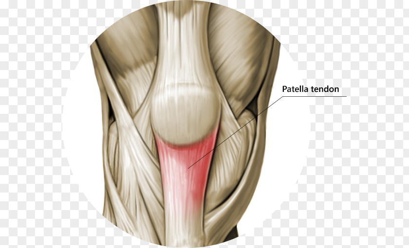 Knee Patellar Tendinitis Tendon Ligament PNG