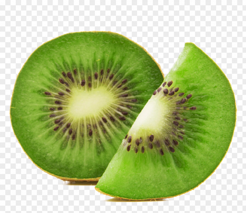 Kiwi Fruit Salad Kiwifruit Juice Vesicles PNG