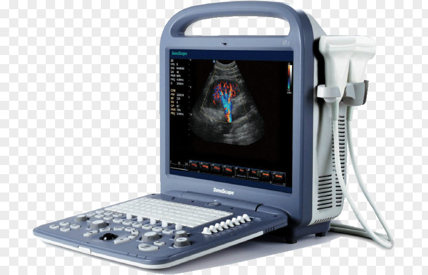 Doppler Echocardiography Portable Ultrasound Ultrasonography SonoScape Medical Corp PNG