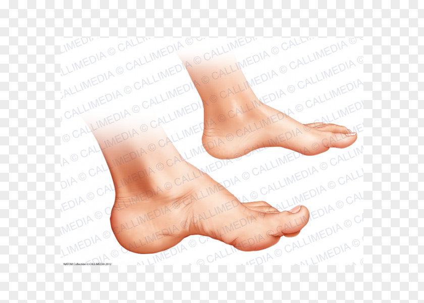Acromegalia Toe Ankle Foot Podiatry Acromegaly PNG