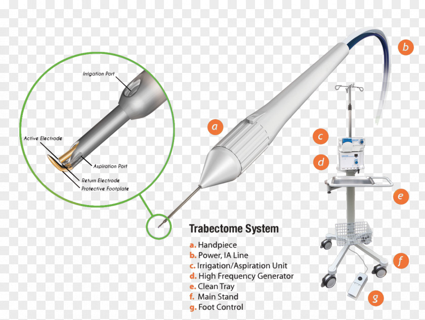 System Trabectome Glaucoma Surgery Ophthalmology PNG