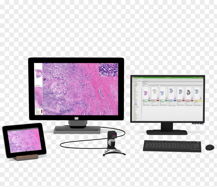Computer Monitors Digital Pathology Data PNG