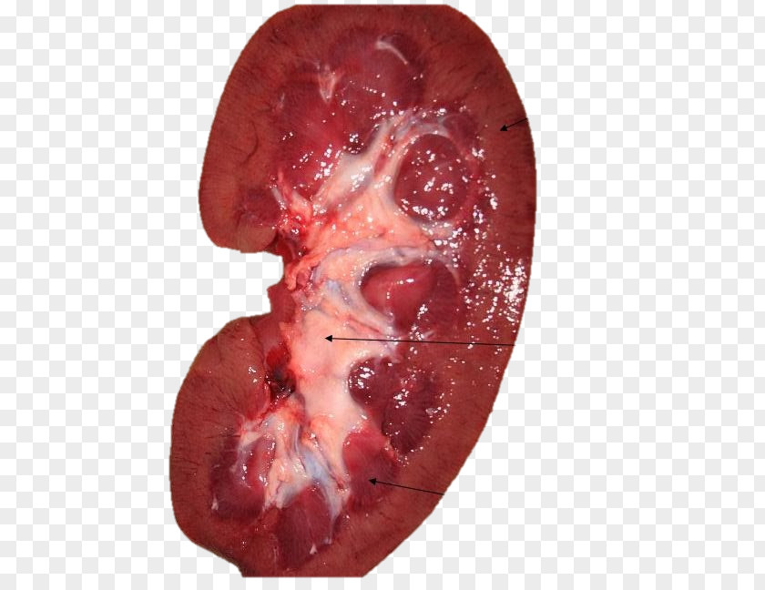 Real Doctors Kidney Nephron Blood Bowman's Capsule Ureter PNG