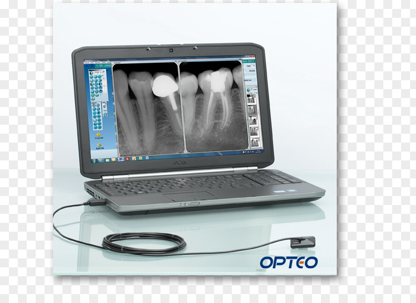 Dental Medical Equipment Dentistry Radiology Sensor Digital Radiography PNG