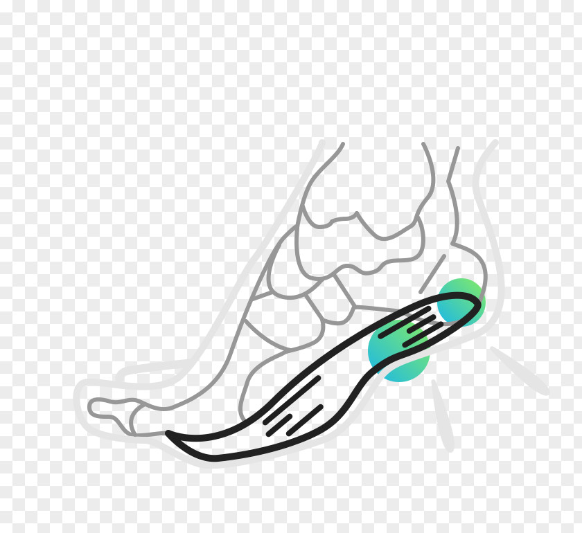 Heel Pain Plantar Fasciitis Foot Calcaneal Spur PNG