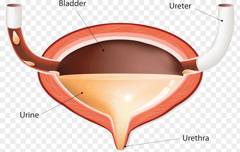 Urinary Bladder Disease Excretory System Incontinence Urine PNG