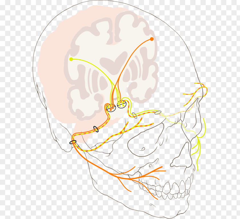 Cranial Bell's Palsy Facial Nerve Paralysis PNG