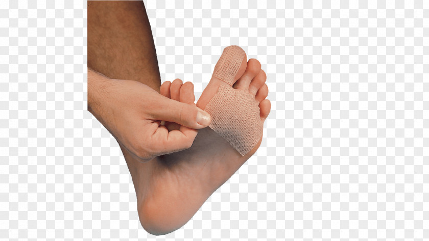 Blisters Amazon.com Blister Skin Dressing Burn PNG