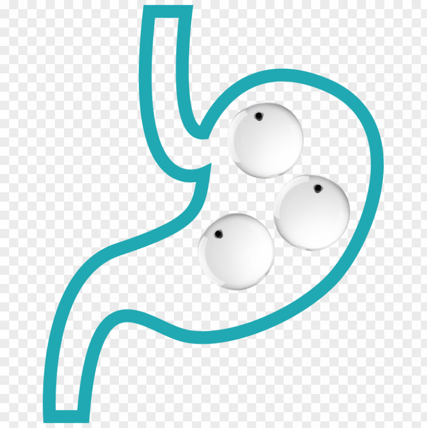 Illustration Balloon Gastric Weight Loss Bariatric Surgery Patient PNG