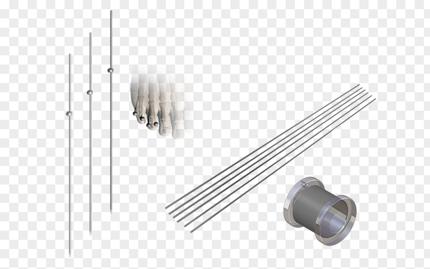 Suture Humerus Length Arm Electrical Cable Millimeter PNG