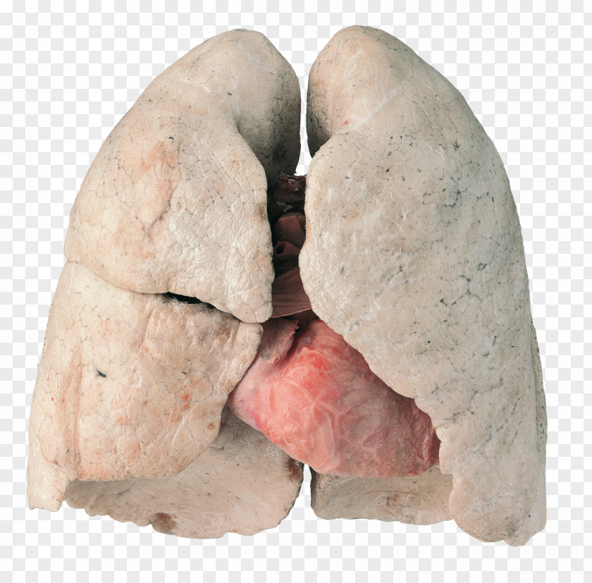 Health Lung Smoking Cessation Chronic Obstructive Pulmonary Disease PNG