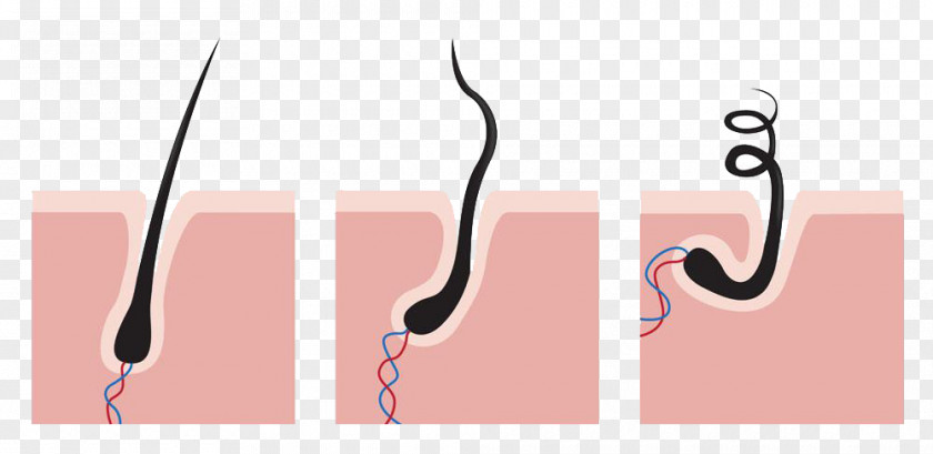 Necrotic Hair Capelli Follicle PNG