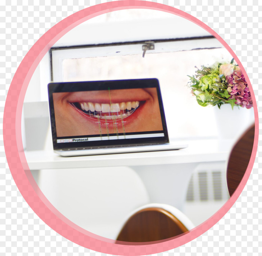 Dental Smile Maria Cardenas, DMD Dentures Dentistry Removable Partial Denture Human Tooth PNG