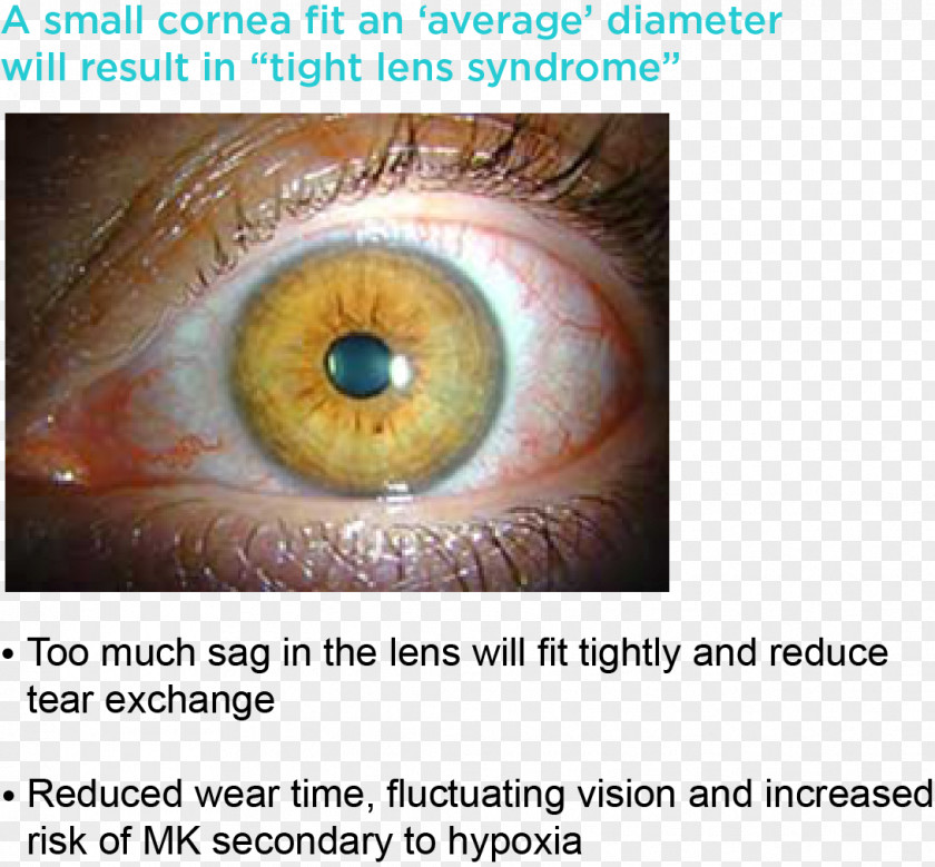 Eye Iris Contact Lenses Cornea Circle Lens PNG