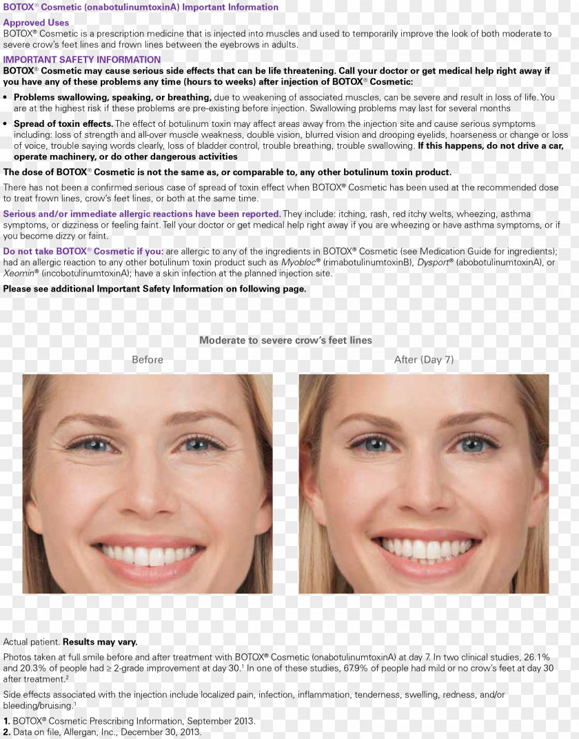 Headache Botulinum Toxin Wrinkle Truly Skin Injection Forehead PNG