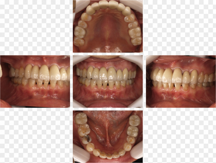 Hashimotokyosei Dental Clinic Dentist 矯正歯科 Therapy Braces Jaw PNG
