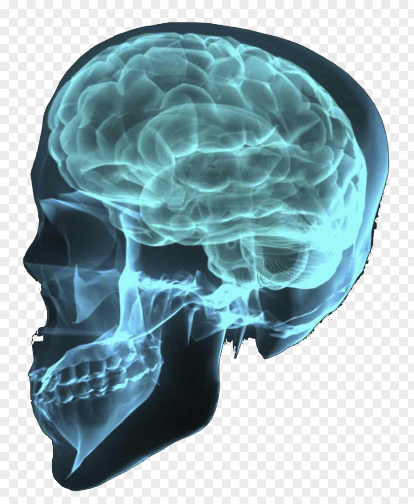 Brain Traumatic Injury Human Tumor PNG