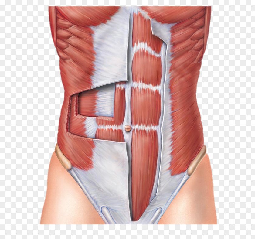 Rectus Abdominis Muscle Abdominal Wall Transverse Abdomen PNG
