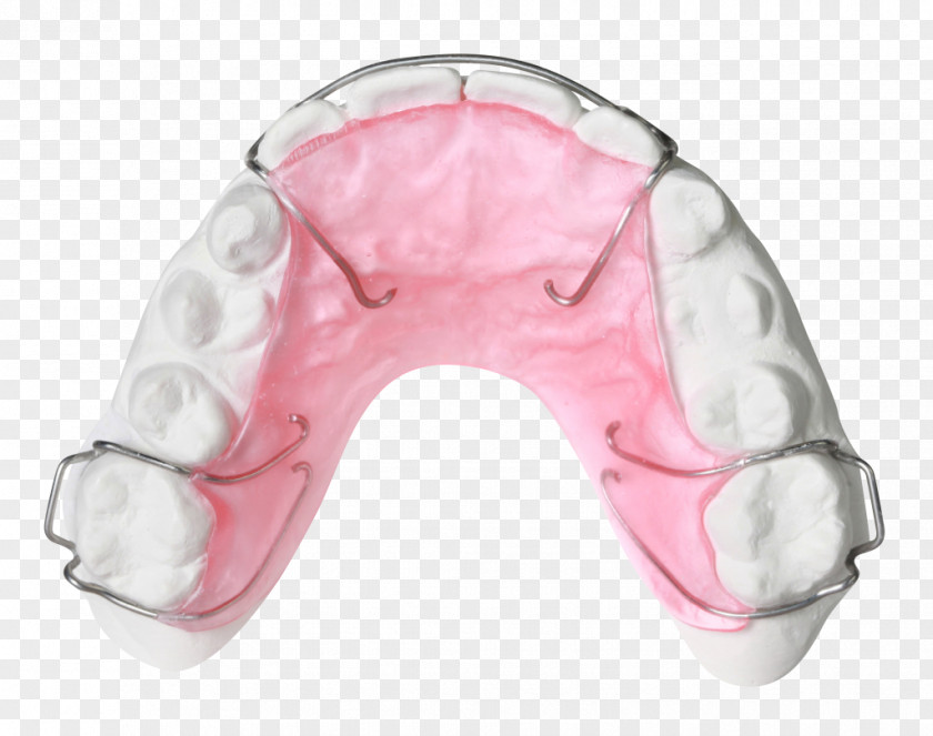 Retainer Orthodontics Orthodontic Technology Jaw Bionator PNG