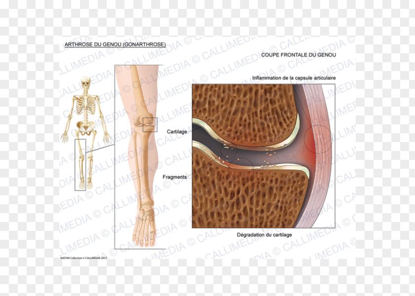 Design Shoulder Fibular Collateral Ligament Knee PNG