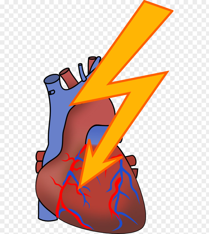 Attack Cliparts Heart Anatomy Human Body Clip Art PNG