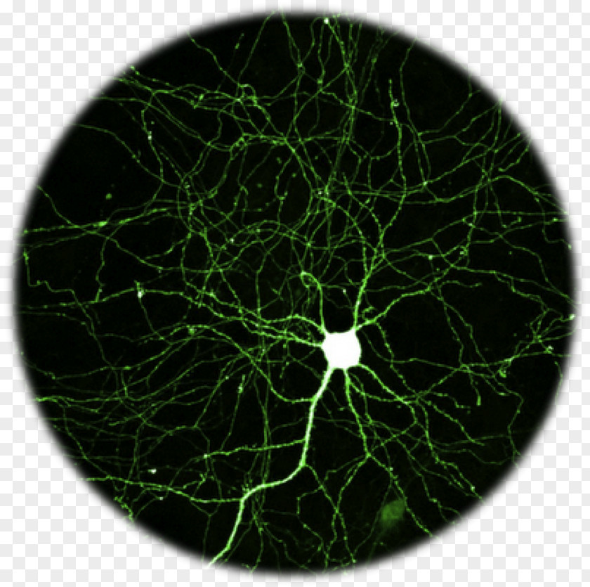 Brain Neuron Green Fluorescent Protein Fluorescence Hippocampus PNG