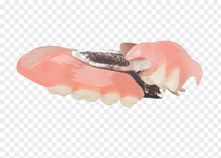 Top Angle Removable Partial Denture Dentures Mouth Dentistry Tooth PNG