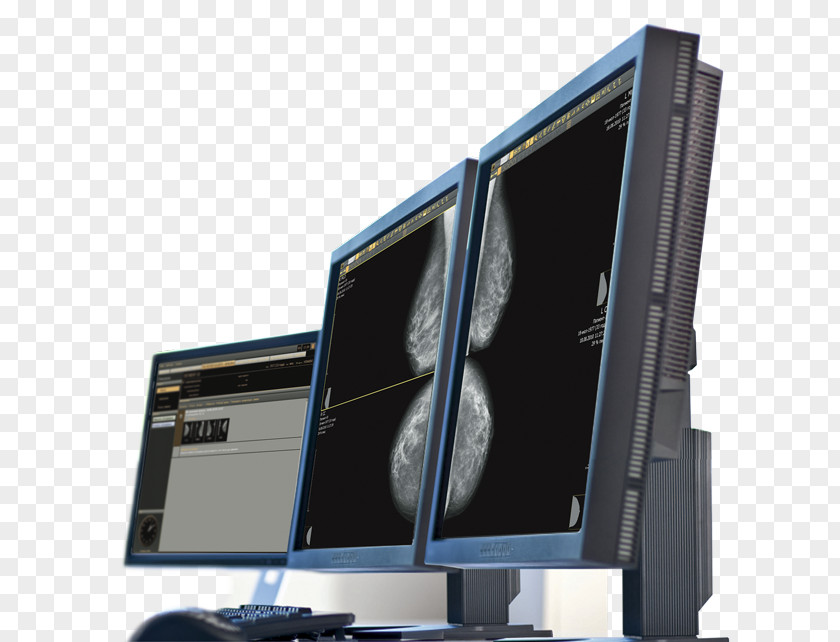 Technology Computer Monitors Hardware Doctor Of Medicine Health PNG