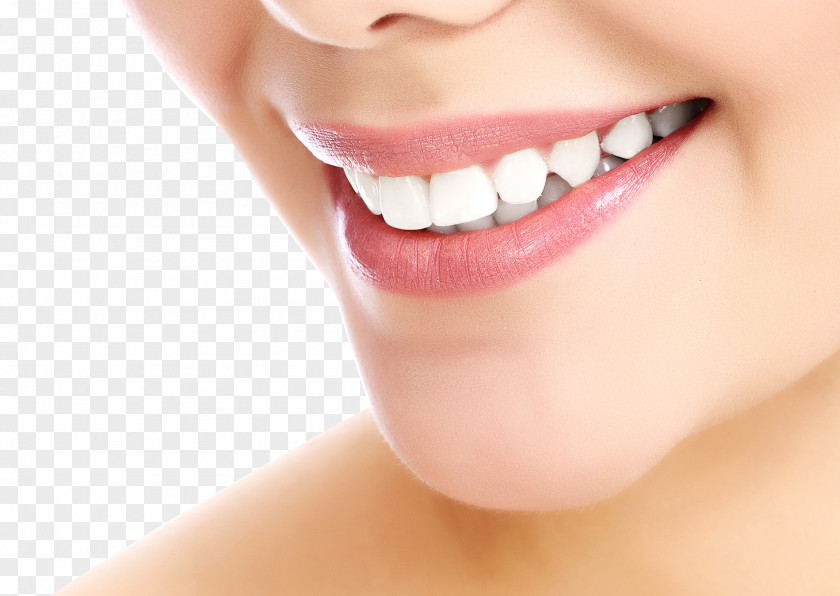 US-tooth Side Cosmetic Dentistry Smile Tooth Whitening PNG