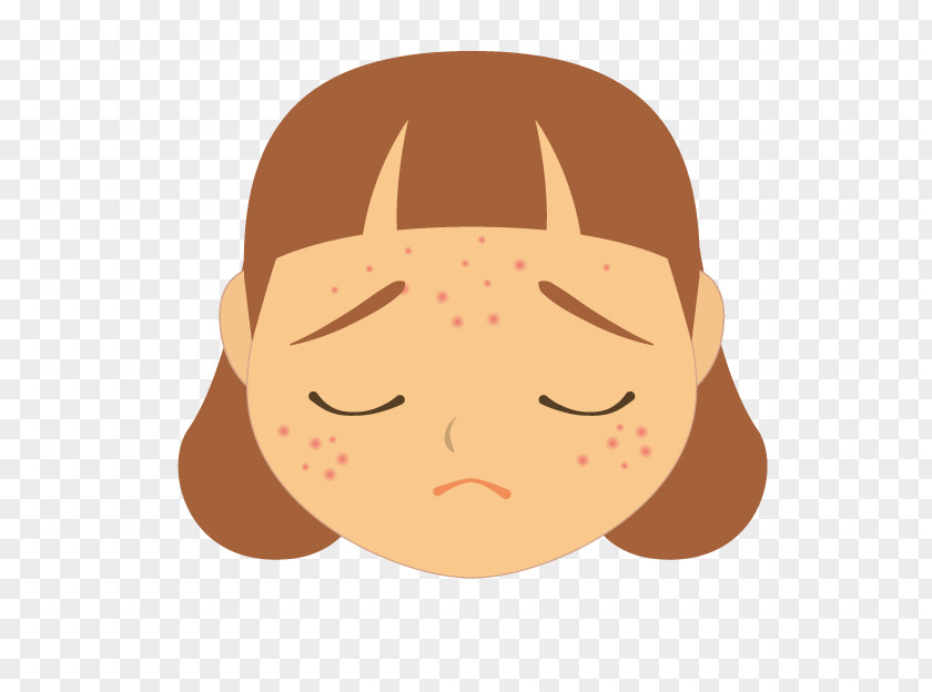 Cartoon Facial Acne Skin Face Dermatology Discoveresearch Inc PNG