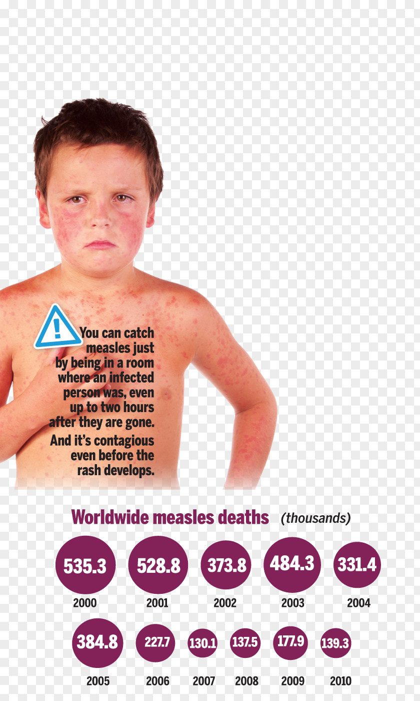 Child Mumps Toddler Testicle Infant PNG