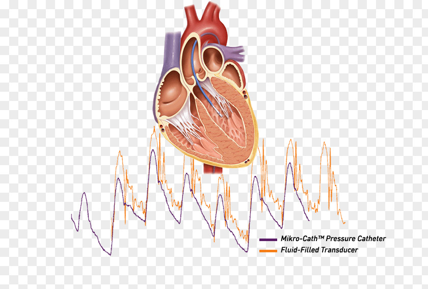 Heart Cardiac Catheterization Ailment Cath Lab PNG