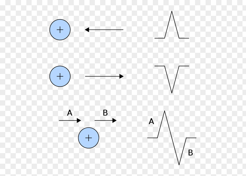 Vector Source File Electrocardiography Electrode Heart Einthoven's Triangle PNG