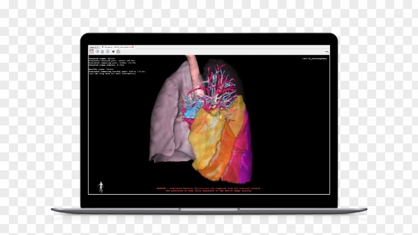 Patient 3d Multimedia Gadget PNG