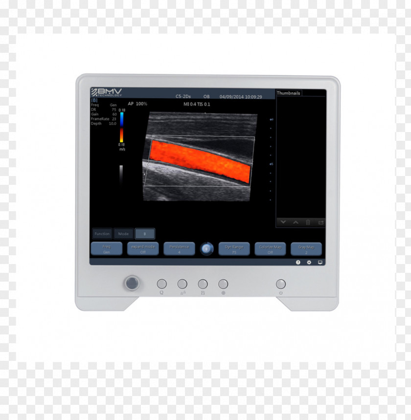 Laptop Display Device Ultrasonography Computer Monitors Ultrasound PNG