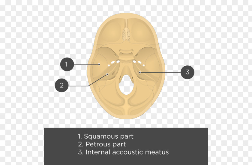 Squama Temporal Bone Anatomy Skull Meatus PNG