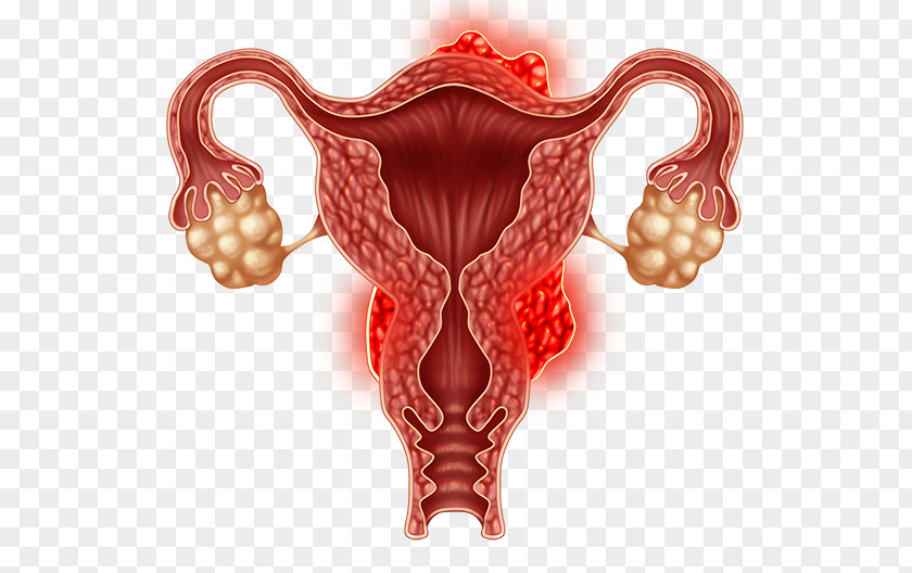 Health Ovary Uterine Fibroid Laparoscopy Uterus Gynaecology PNG