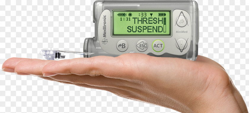Insulin Administration Pump Minimed Paradigm Medtronic Diabetes Mellitus PNG